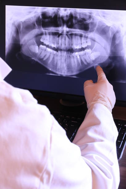 Best Emergency Root Canal Therapy in Bossier City, LA